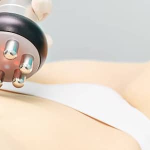 Fat Reduction Localized